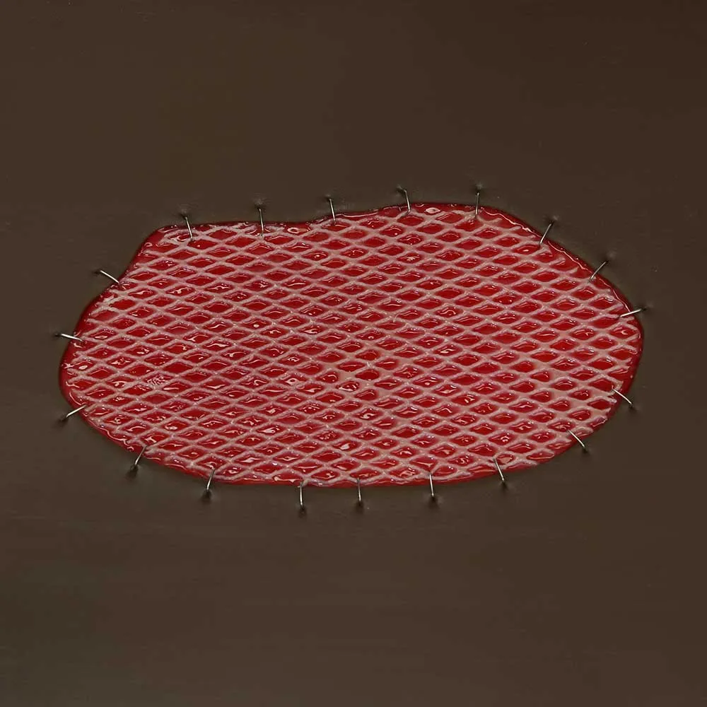 Skin Graft Wound Board, Dark Skin